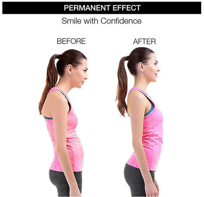 AlignWell Shoulder & Back Corrector
